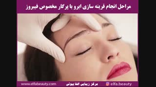 قرینه سازی ابرو در روش میکروبلیدینگ فیبروز