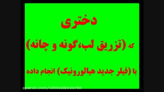 تزریق لب، گونه و چانه با فیلر( هیالورونیک اسید) روکش دندان