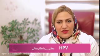 زگیل تناسلی