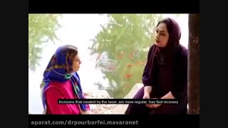 جراحی لابیاپلاستی