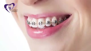 ناهنجاری دندان و فک | دکتر فاضل فیروزی پوسیدگی دندان