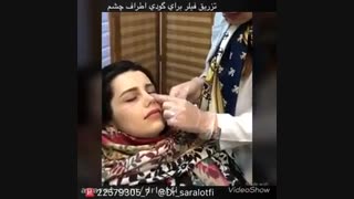 تزریق فیلر برای گودی زیر چشم هایفوتراپی