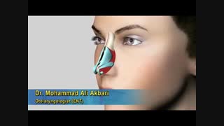 جراحی بینی گوشتی | دکتر محمدعلی اکبری برداشتن خال گوشتی
