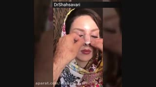 نحوه چسب زدن بینی