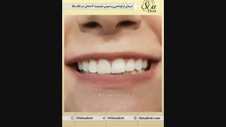 کلینیک دندان در تهران | سیمادنت