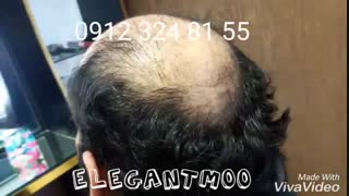 ترمیم مو /الگانت 02188962259