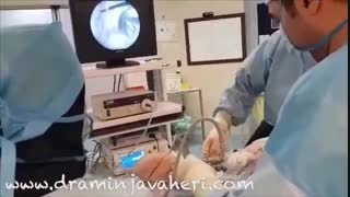 بازسازی رباط صلیبی قدامی به کمک اتوگرفت (پارت3)