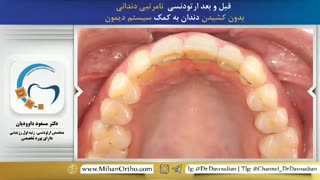 ارتودنسی در تهران | دکتر مسعود داودیان