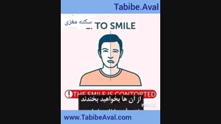 چگونه سکته مغزی را تشخیص دهیم؟