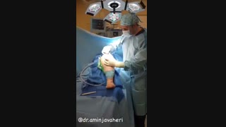 جراحی تعویض مفصل لگن ( پروتز و جااندازی سرپروتز )