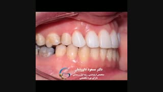 دکتر ارتودنسی | دکتر داوودیان