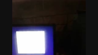 جمالی مقدم پر کردن دندان
