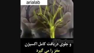 سندرم لرزان در نوزادان