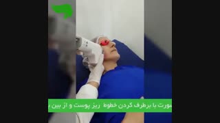 جوانسازی صورت