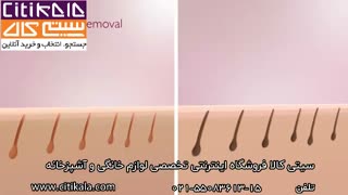 اپیلاتور فیلیپس مدل HP6420 - سیتی کالا نمایندگی محصولات فیلیپس