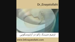 ترمیم منیسک زانو