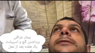 برداشت گچ بیمار عراقی