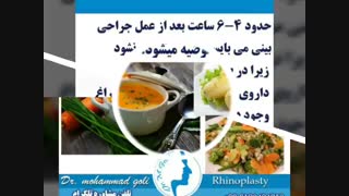 باید و نباید های رژیم غذایی بعد از عمل بینی