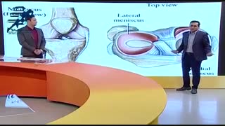 پارگی منیسک زانو